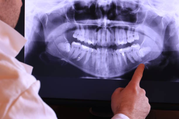 Best Walk-In Emergency Dentist in Chatham, IL